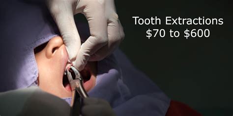 The typical total <b>cost</b> of wisdom <b>teeth</b> elimination without insurance ranges from: Easy <b>Extraction</b> — $70-$220 (per <b>tooth</b>) $250. . Banfield tooth extraction cost